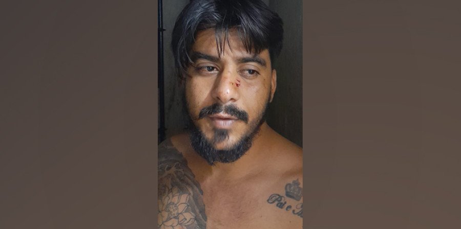As agressões de Antonio deixaram marcas no corpo do filho (Foto: Divulgação)