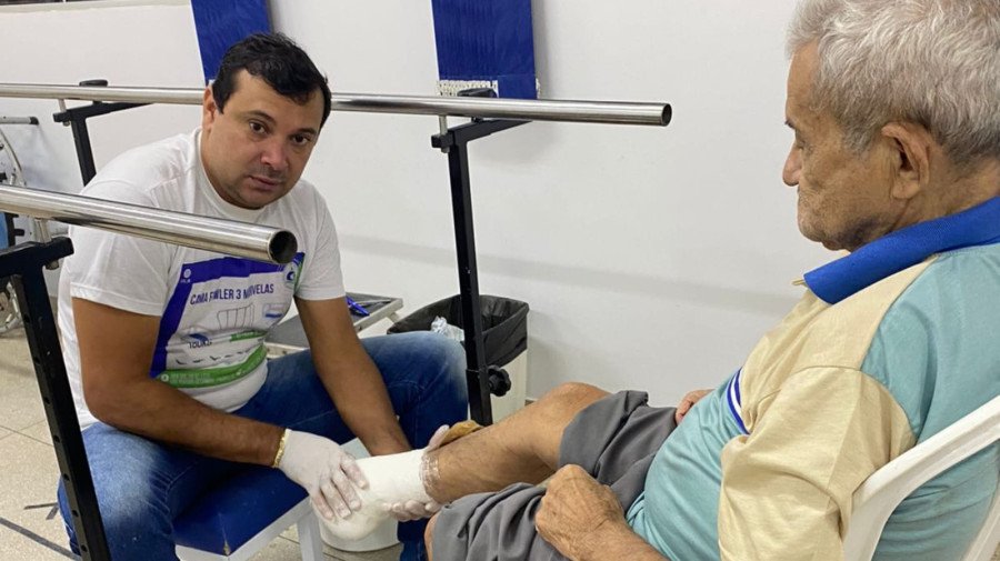 Em Araguaína serão atendidos 100 pacientes para a entrega de próteses de amputação transtibial, transfemural, transradial e mamária